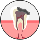 치아 전체 단계